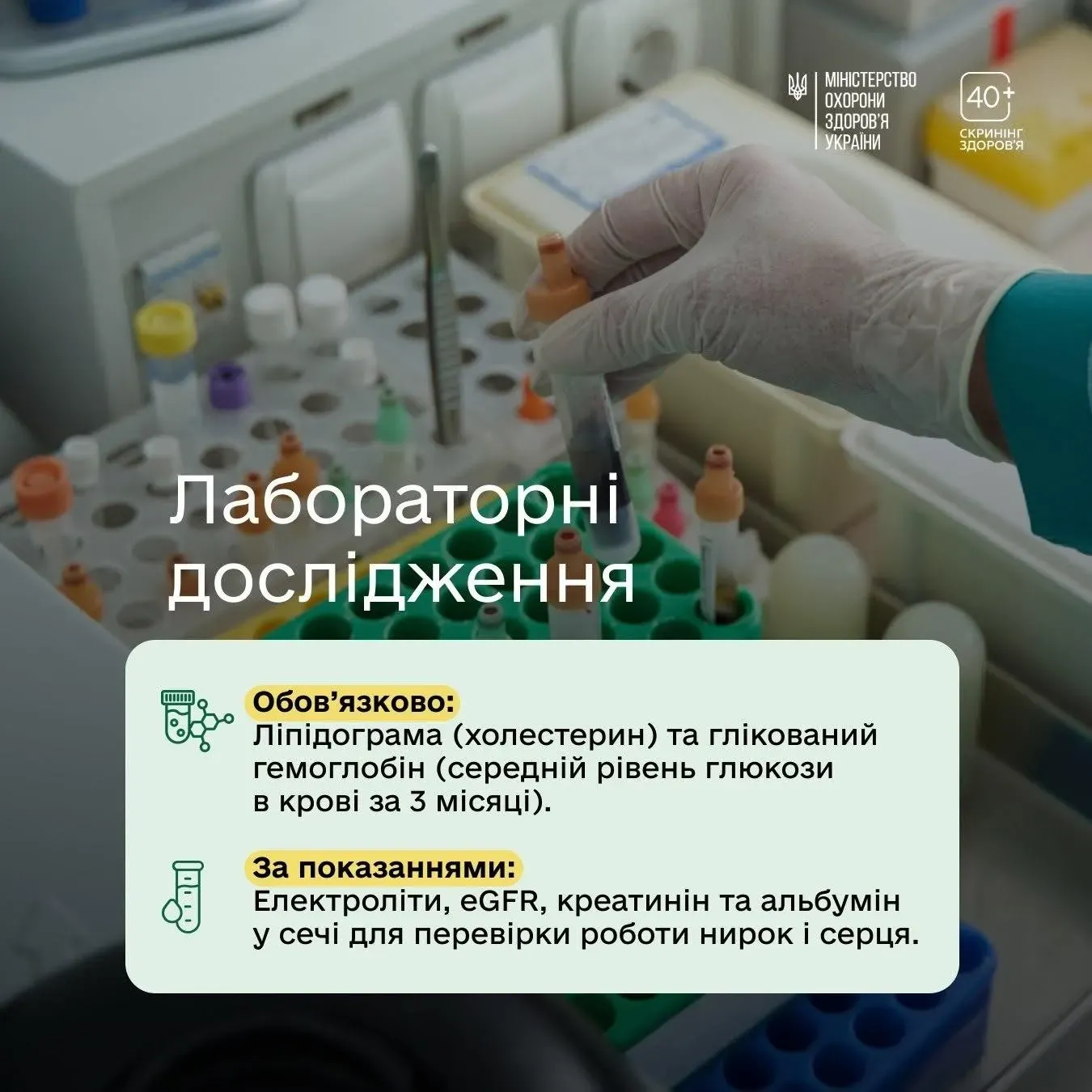 Півмільйонна аудиторія в YouTube: СБУ викрила харківського блогера-втікача на пропаганді
